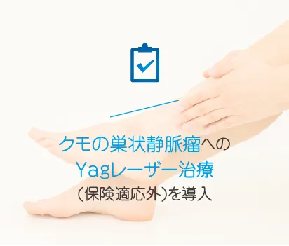 クモの巣静脈瘤へのYagレーザー治療(保険適応外)を導入